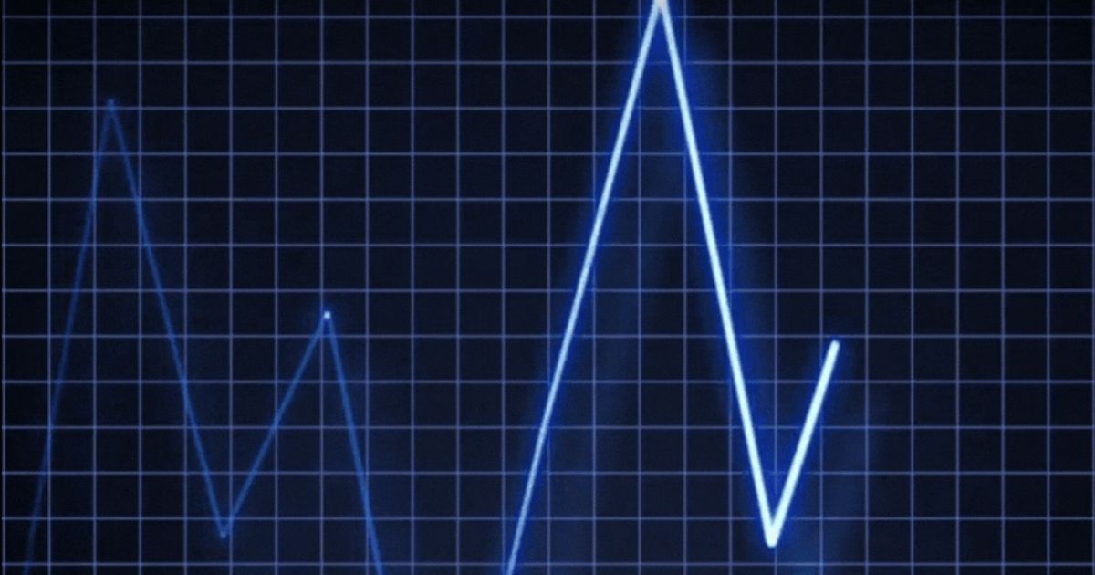 Heart Rate Variability (HRV) and How It Affects Your Recovery