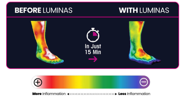 LUMINAS Foot Pain Relief Patch thermography results 