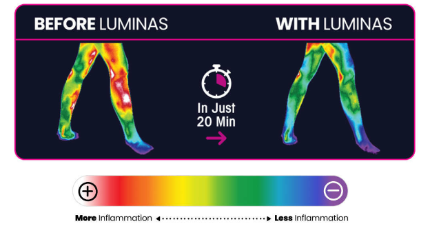 LUMINAS Knee Pain Relief Patch thermography results